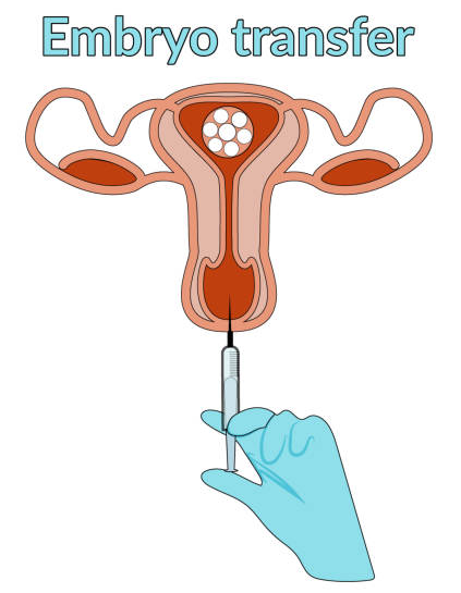 Is It Normal to Have Cramping 5 Days After Embryo Transfer?